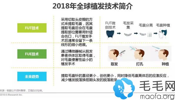 广东省毛发移植技术的探索与实践